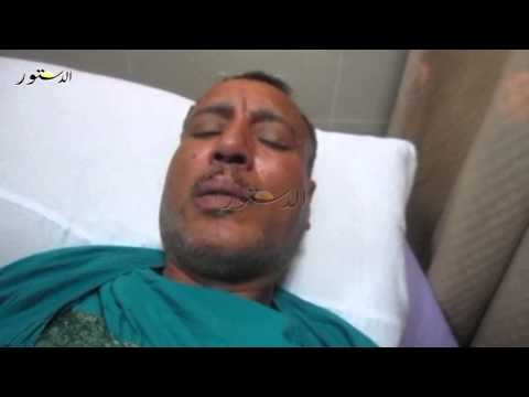 مصاب انفجار مدينة نصر يروي تفاصيل الحادث