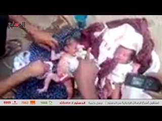 الدستور | العثور على طفلين «توأم» داخل مقابر أسوان