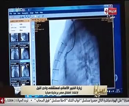 أستاذ طب بجامعة ميونيخ: سعيد بزيارة بمستشفى وادى النيل