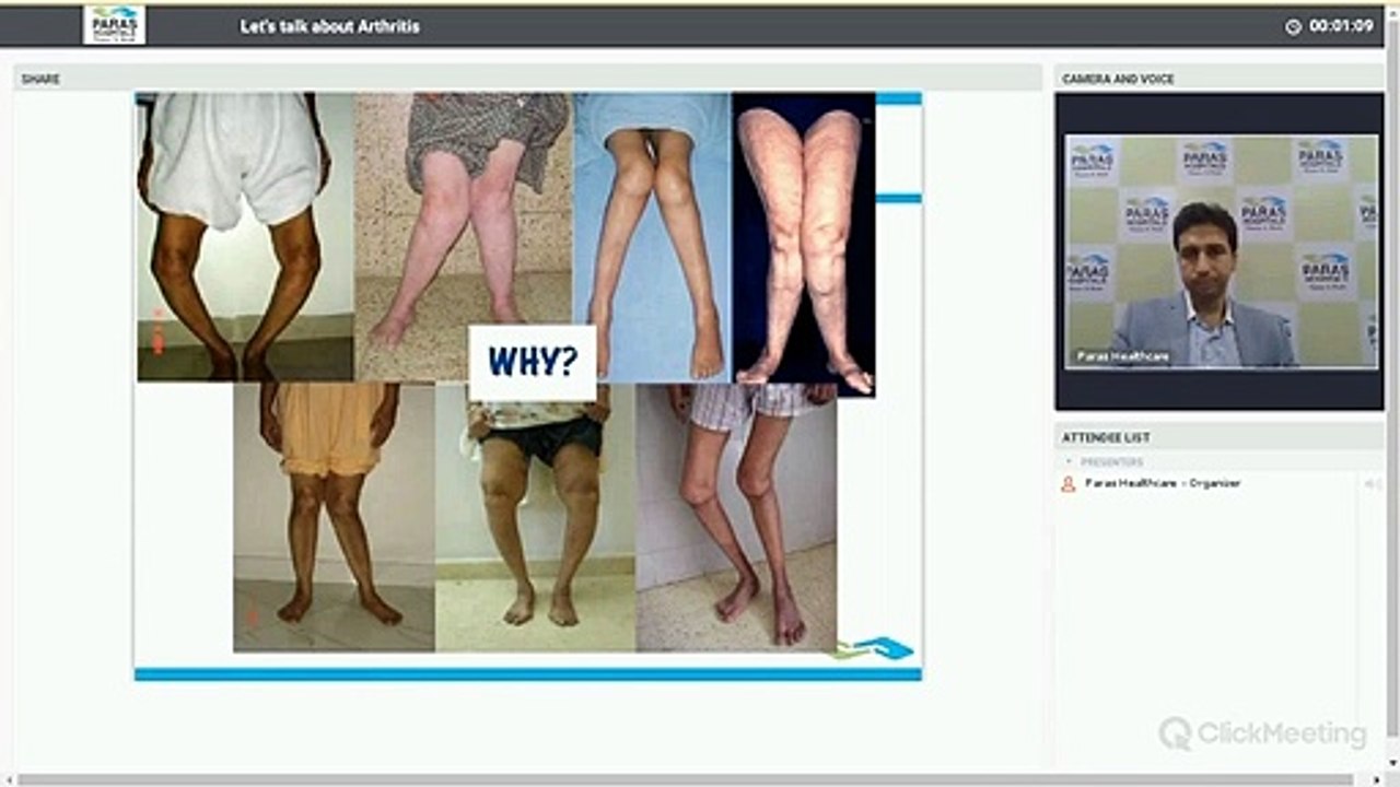 #पारसहॉस्पिटल Live Webinar | Arthritis | Dr Rahul Kumar, Paras Hospitals