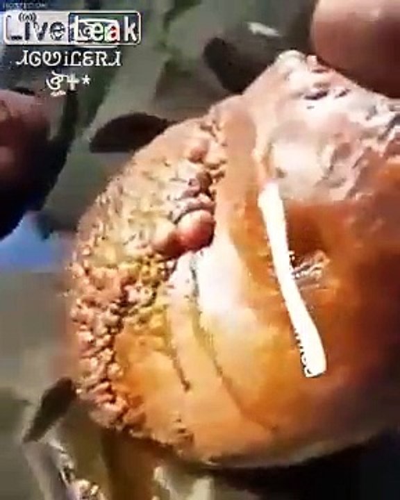 L'horrible maladie de peau de cette femme.. la taille de son bras !