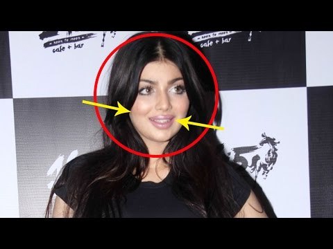 Ayesha Takia is UNRECOGNISABLE after horrible PLASTIC SURGERY!