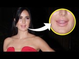 Has Katrina Kaif plumped up her lips?