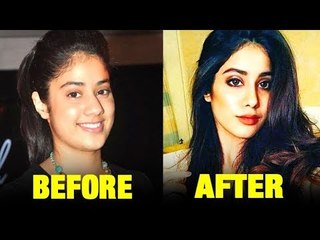 Has Sridevi’s Daughter Jhanvi Kapoor Done A Nose Job ?