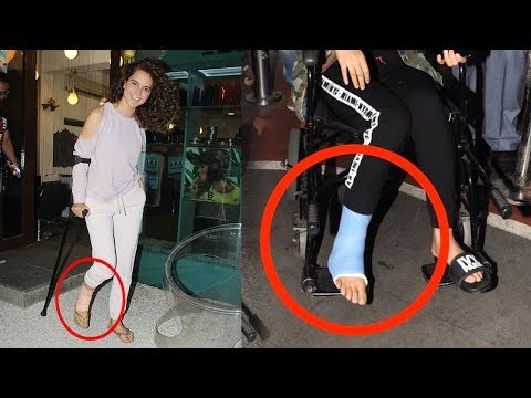 Kangana Ranaut Spotted Walking With Fractured Leg In Pain Outside Beauty Parlor In Bandra