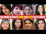 SHOCKING Plastic Surgery of Bollywood Actresses BEFORE & AFTER | Sridevi,Anushka,Aishwarya,Priyanka