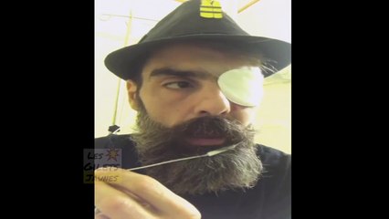message Jerome Rodrigues après avoir perdu un de ses yeux