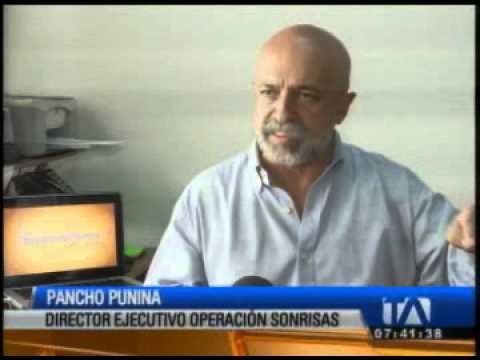 'Operación Sonrisas' evaluará pacientes con fisuras de labio y paladar hendido