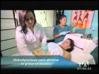 ¿Cómo bajar de peso sin necesidad de pasar por una cirugía? Entérese