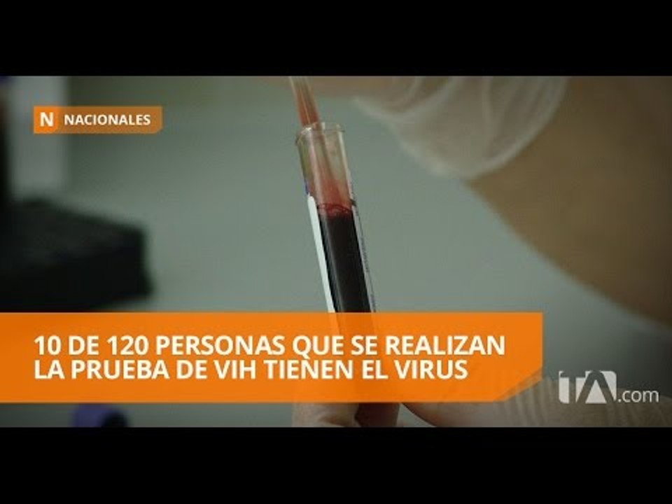 10 de 120 personas que se realizan la prueba de VIH tienen el virus