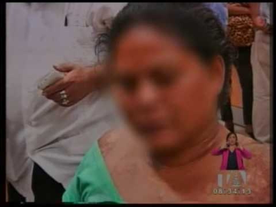 Entrevista a Gina Potes sobre ataques con ácido en Ecuador - Teleamazonas