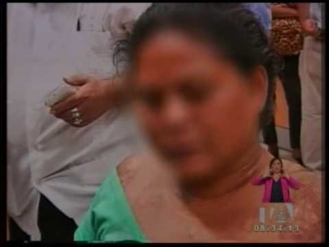 Entrevista a Gina Potes sobre ataques con ácido en Ecuador - Teleamazonas