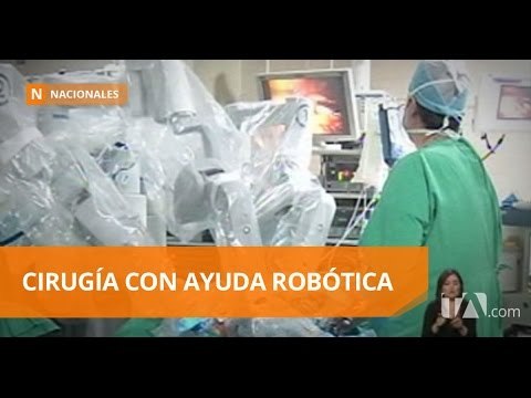 Cirugías de vesícula y útero con ayuda del robot da Vinci