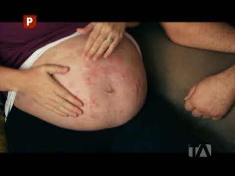 Ecos: Embarazos Extraños II - Teleamazonas