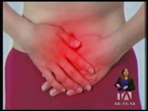 Al menos un 15% de ecuatorianos tiene cálculos en la vesícula