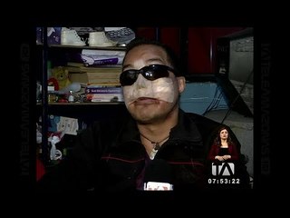 Larry quedó desfigurado por una descarga eléctrica