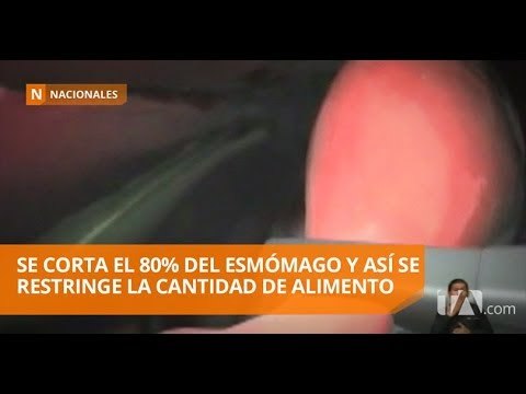 Tratar de perder peso con dieta y ejercicios puede ser frustrante - Teleamazonas