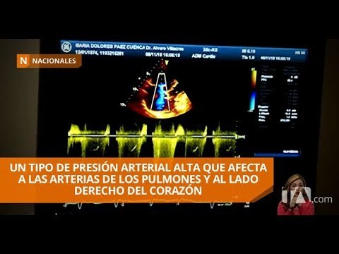 Noviembre es el mes de los pacientes con hipertensión pulmonar - Teleamazonas