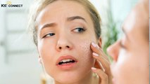 कैसे पहचाने अपनी स्किन टाइप - How to Identify your Skin Type - Oily Skin - Dry Skin - key2connect