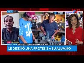 El profesor que fabricó una prótesis a su alumno