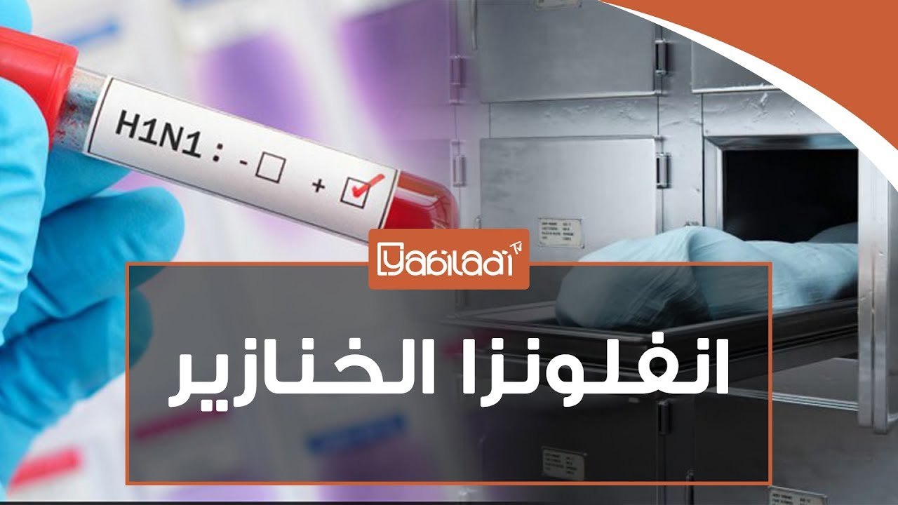 انفلونزا الخنازير تتسبب في وفاة 5 أشخاص بالمغرب