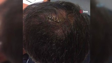 Şenol Güneş'in Yaralandığı Olaylı Derbi Soruşturmasında 46 Şüpheliye Ceza İstemi