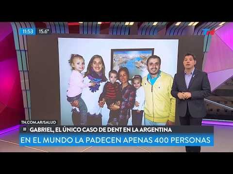 El argentino con una enfermedad que sólo padecen 400 personas en el mundo