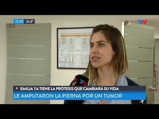 Emilia y la prótesis que cambió su vida