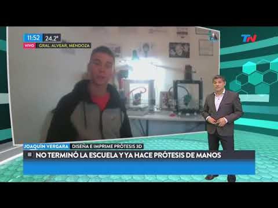 Con Bienestar: No terminó la escuela y ya hace prótesis de manos