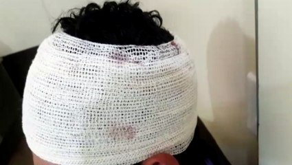 Jovem é atingido por pedrada na cabeça no Bairro Tarumã