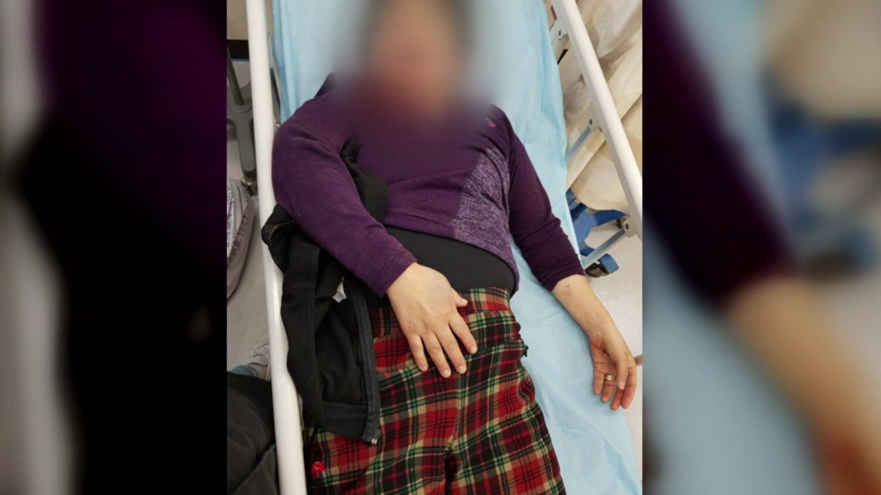 女 택시기사 무차별 폭행..."술 취해 기억 안 나" / YTN