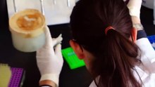 The Woman Whose Legs Turned Black - Cryoglobulinemia (Medical Documentary)