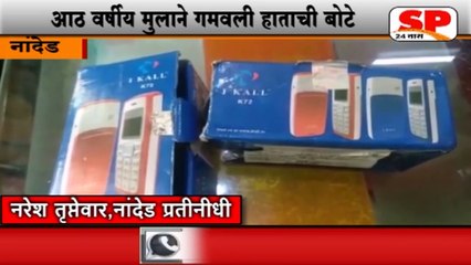 नांदेड-मोबाईलच्या स्फोटात चिमुकल्याची गेली पाचही बोटे...SP24 NEWS