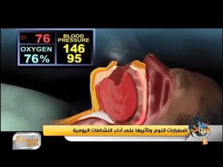 اضطرابات النوم وتأثيرها على أداء النشاطات اليومية