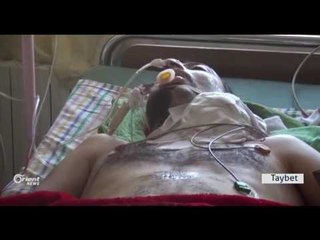 Orient News rewşa birîndarên teqîna Hesekê dişopîne