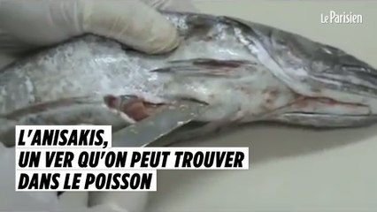 Anisakis, le ver que l'on peut trouver dans le poisson