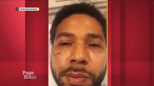 We have an update on the investigation of the @jussiesmollett attack in Chicago. An empty hot sauce bottle that smelled like bleach was found near the incident, and police are still looking for two persons of interest. Watch #PageSixTV for the full stor