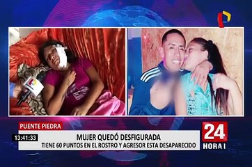 Puente Piedra: joven de 19 años quedó desfigurada tras ser agredida por su pareja