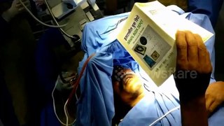 Patient stays awake during brain surgery by reading passages from Quran