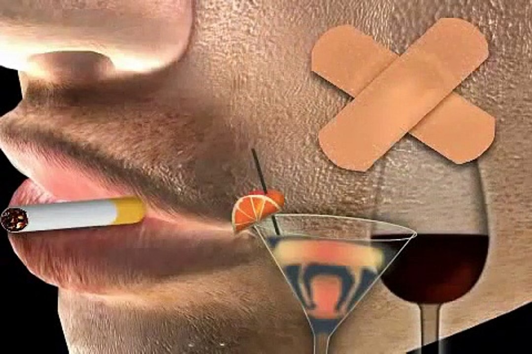 wie sieht Zungenkrebs aus