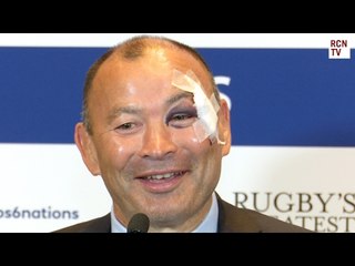Eddie Jones Interview Embarrassing Bathroom Accident