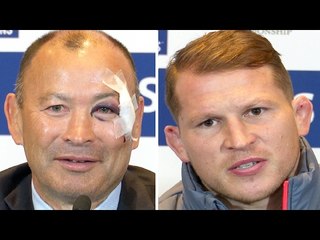 England Rugby Six Nations 2017 Press Conference