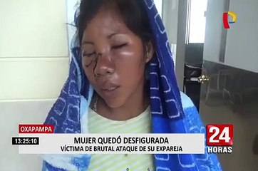 Oxapampa: sujeto desfigura a su expareja a pesar de orden de alejamiento