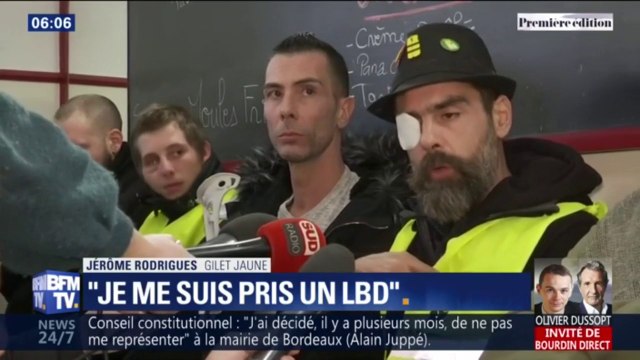 Je me suis pris un LBD. Jérôme Rodrigues réaffirme avoir été victime de violence policière