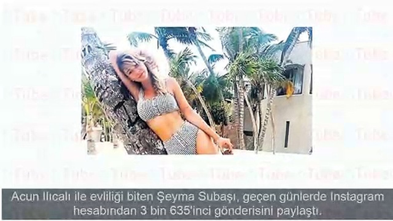 Şeyma Subaşı estetik mi yaptırdı?