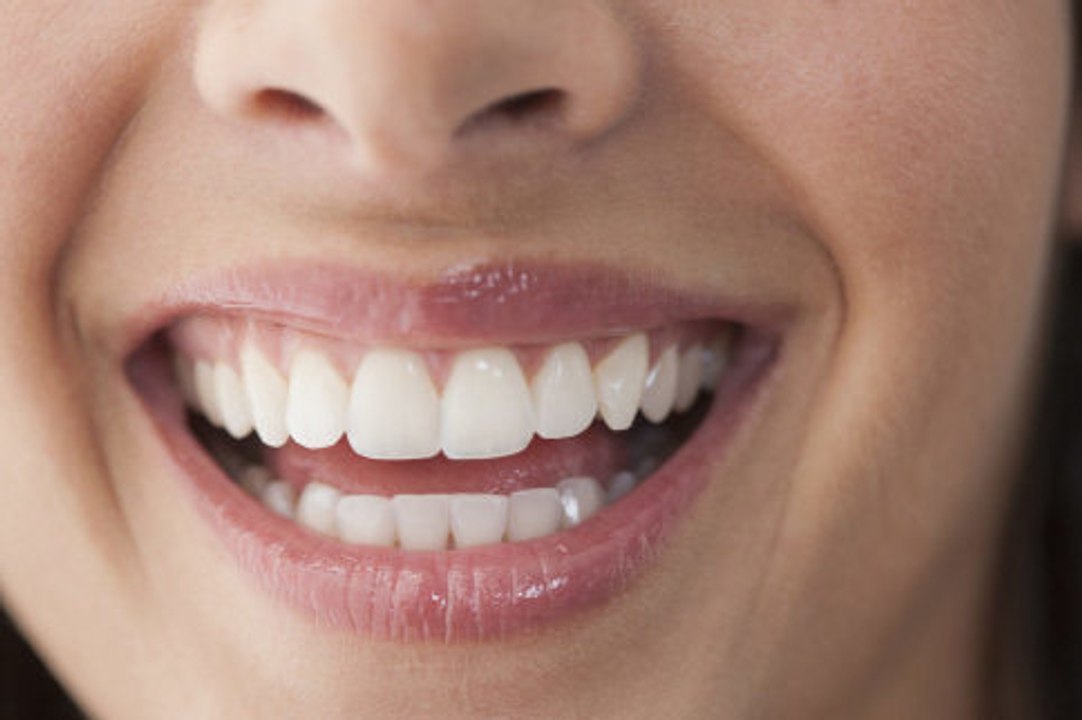 5 Tipps für weißere Zähne