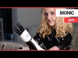 Teenager who lost both hands as a child applies makeup using bionic arm | SWNS TV