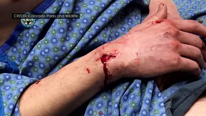An American man describes mountain lion attack