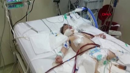 İzmir 8 Defa Kalbi Duran Mucize Çocuk Hayata Tutundu