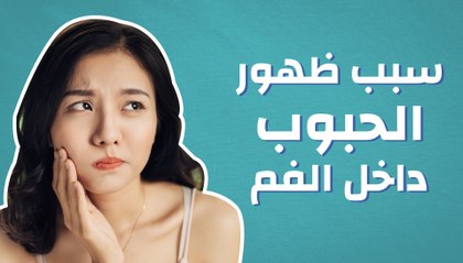 سبب ظهور الحبوب داخل الفم